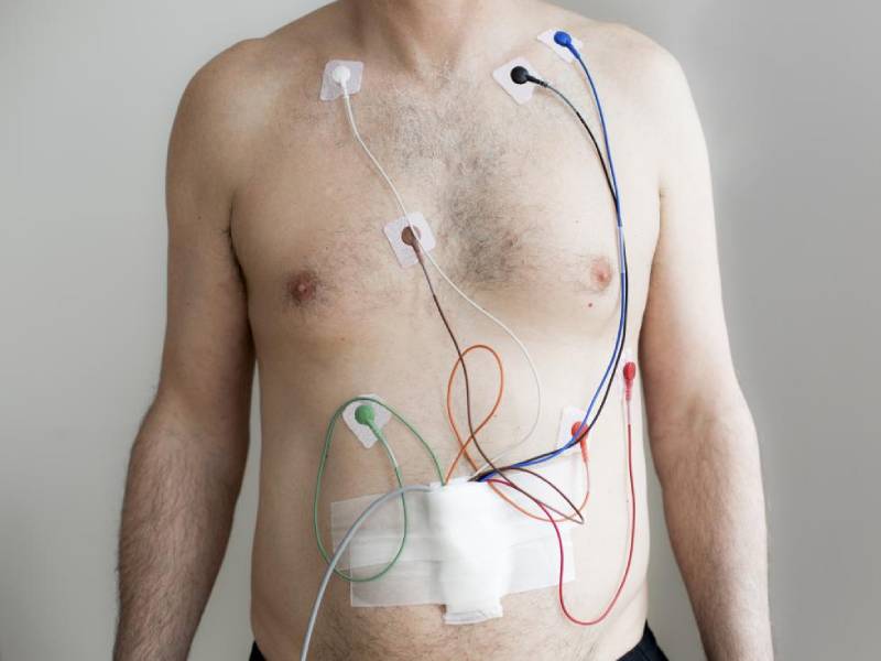 ECG Holter Monitoring For Comprehensive Heart Care
